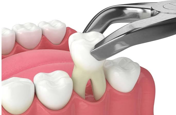 Tooth Repair & Removal