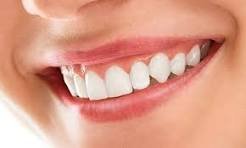 Smile Makeover
